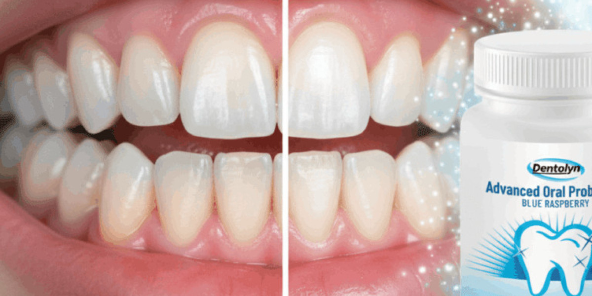 Dentolyn Oral Health Capsules Review – Natural Formula for Fresh Breath & Gum Support