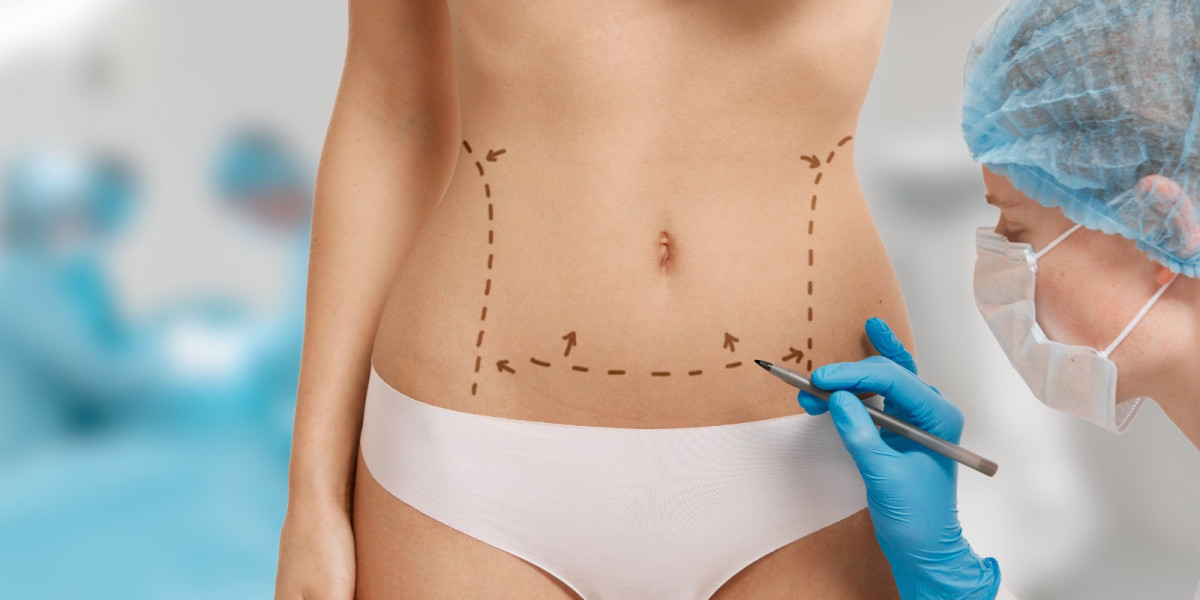 The Science Behind Liposuction: How It Really Works
