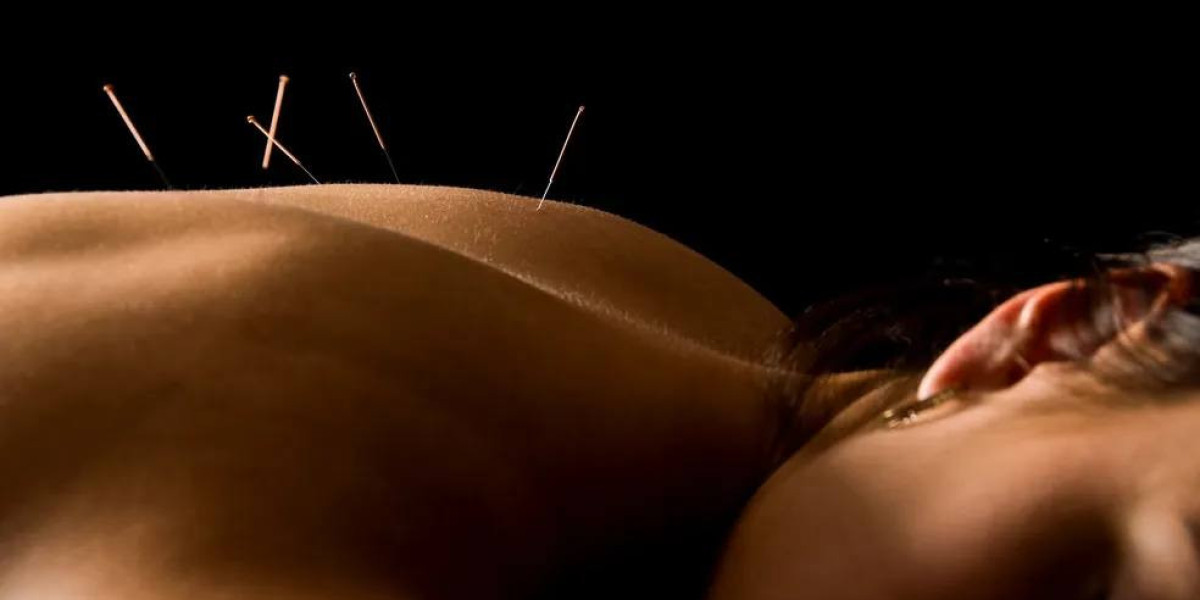 Acupuncture For Shoulder Pain NYC
