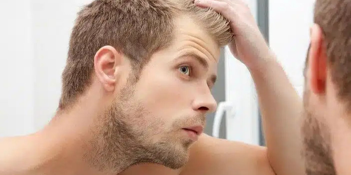 Scalp Micropigmentation vs Hair Transplants Which One Is Right for You