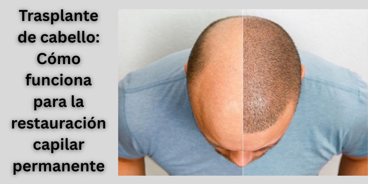 Trasplante de cabello: Cómo funciona para la restauración capilar permanente